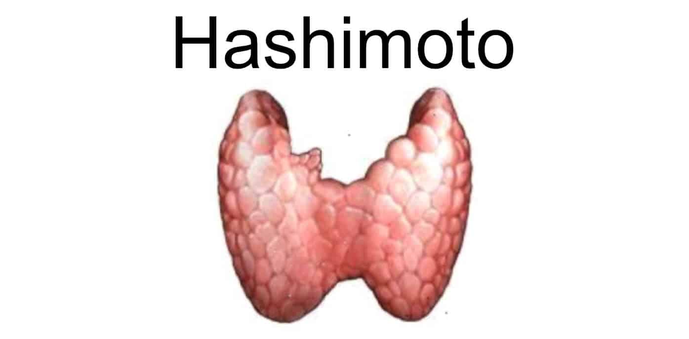 Artikel update Hashimoto