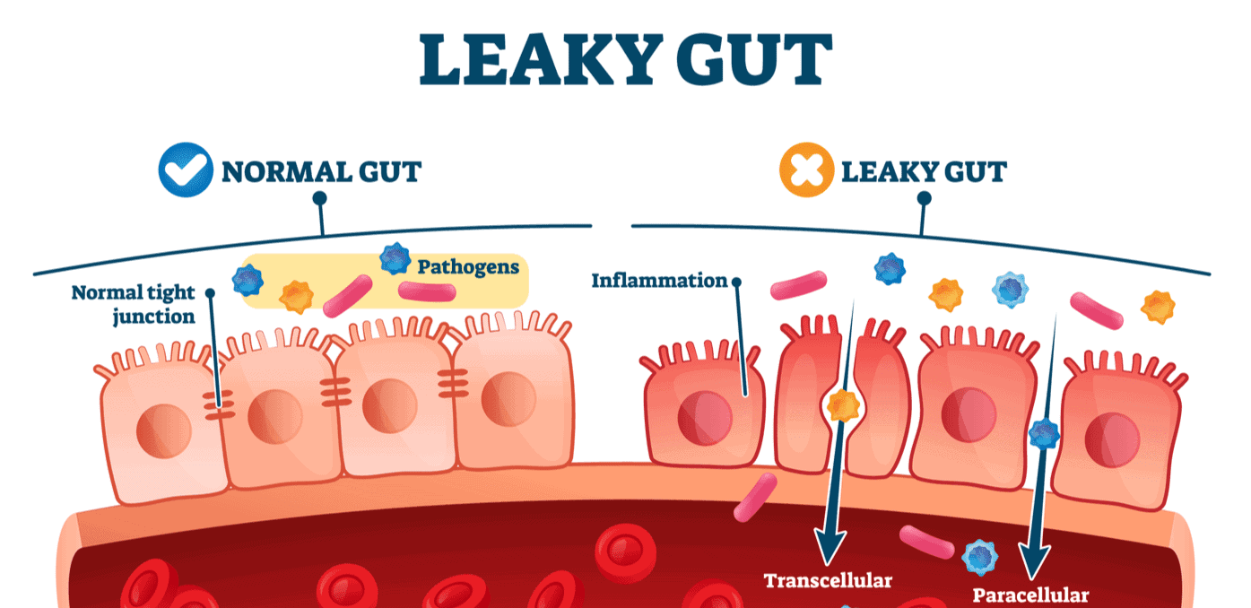Lekkende darm (leaky gut) symptomen, testen, oorzaken en herstellen. Blog