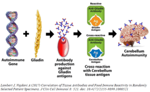 Kruisreactie gluten gliadine met cerebellum hersenen. Lambert J, Vojdani A (2017).